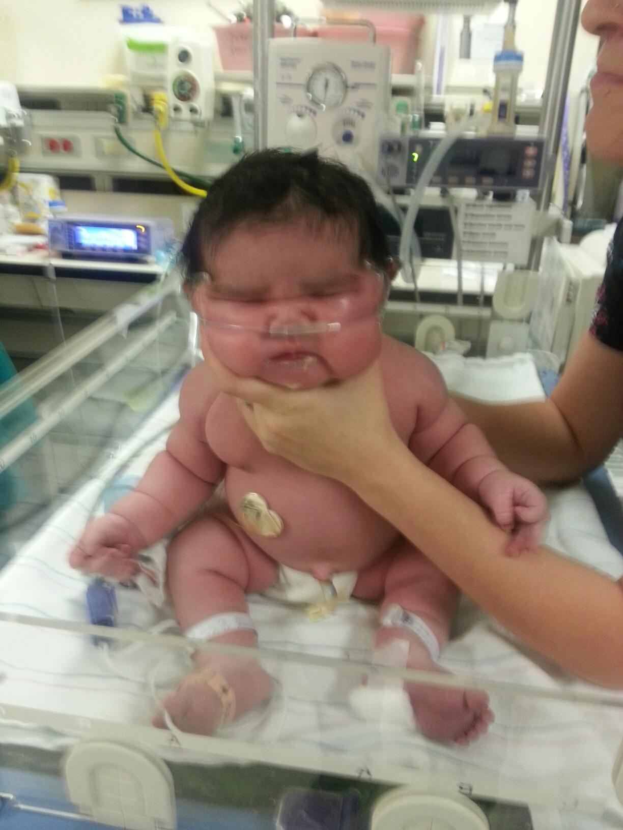 Woman Has 13 Pound Baby