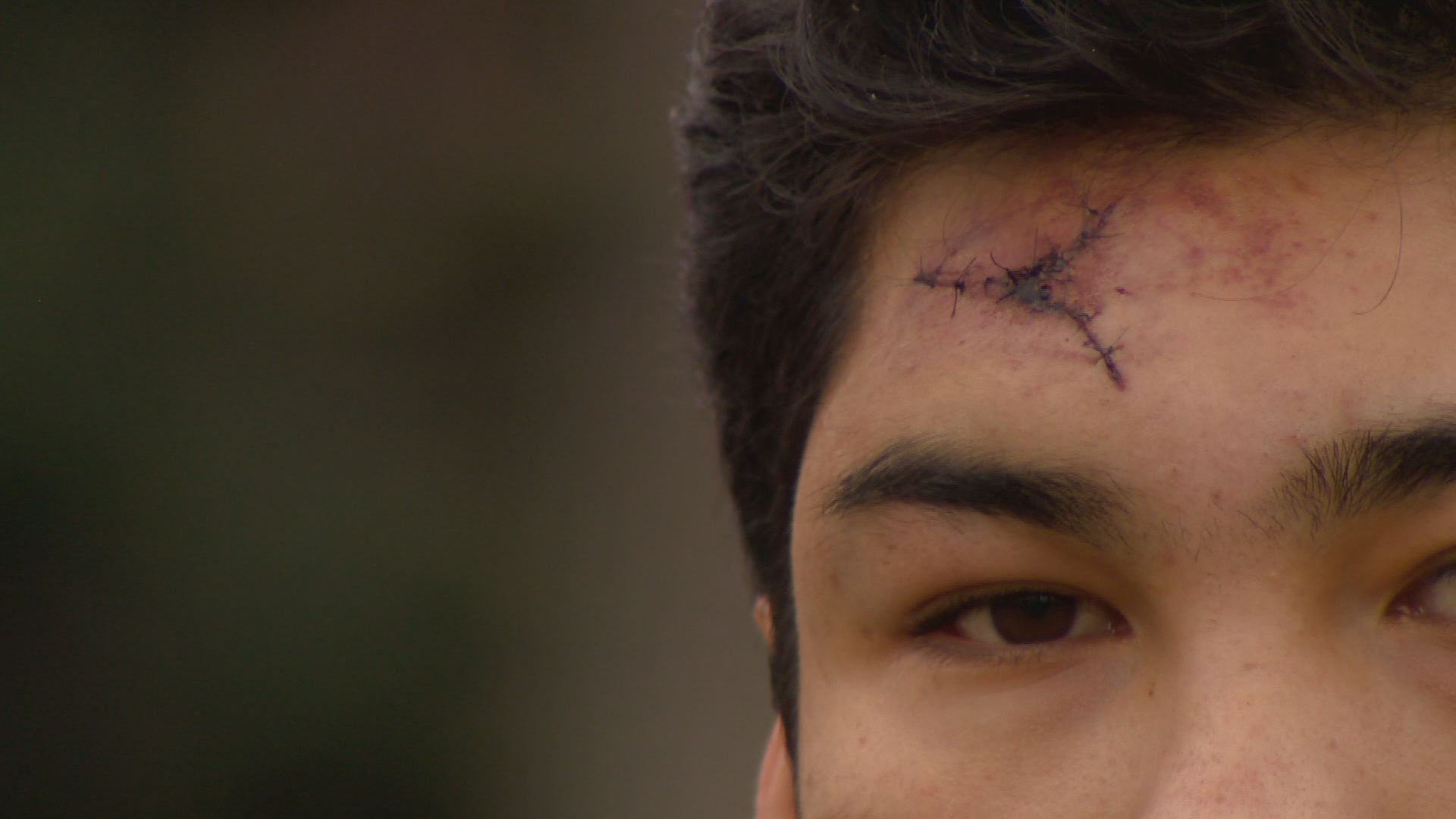 Family demands justice after fight