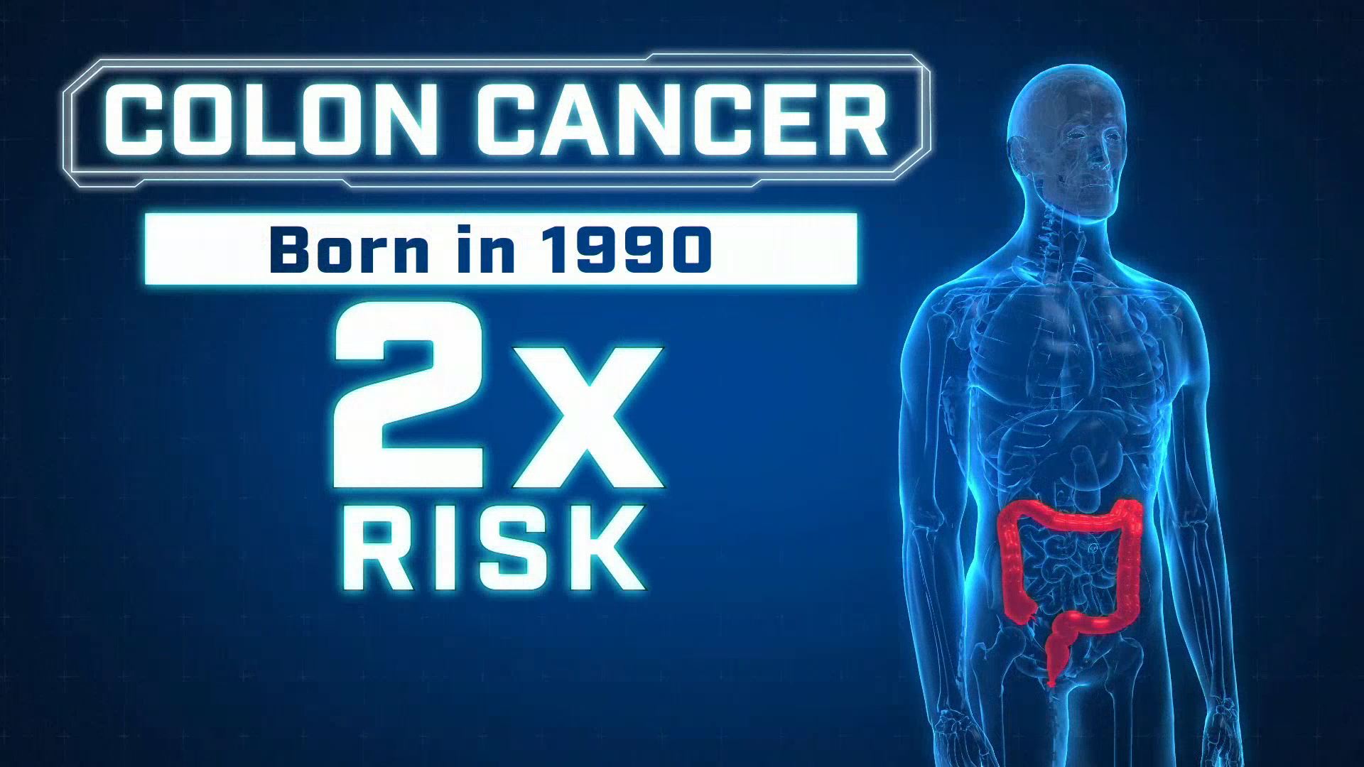 Study shows colorectal cancer on the rise with millennials | 9news.com